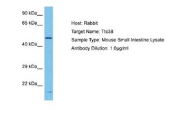 TTC38 Rabbit anti-Mouse, Polyclonal, Novus Biologicals 0.1 mL | Buy Online | Novus Biologicals | Fisher Scientific